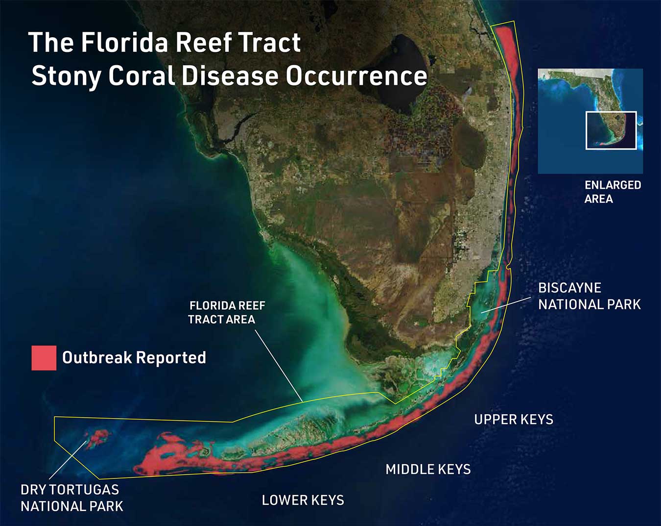Infographic of the Florida Reef Tract Stony Coral Disease Occurence